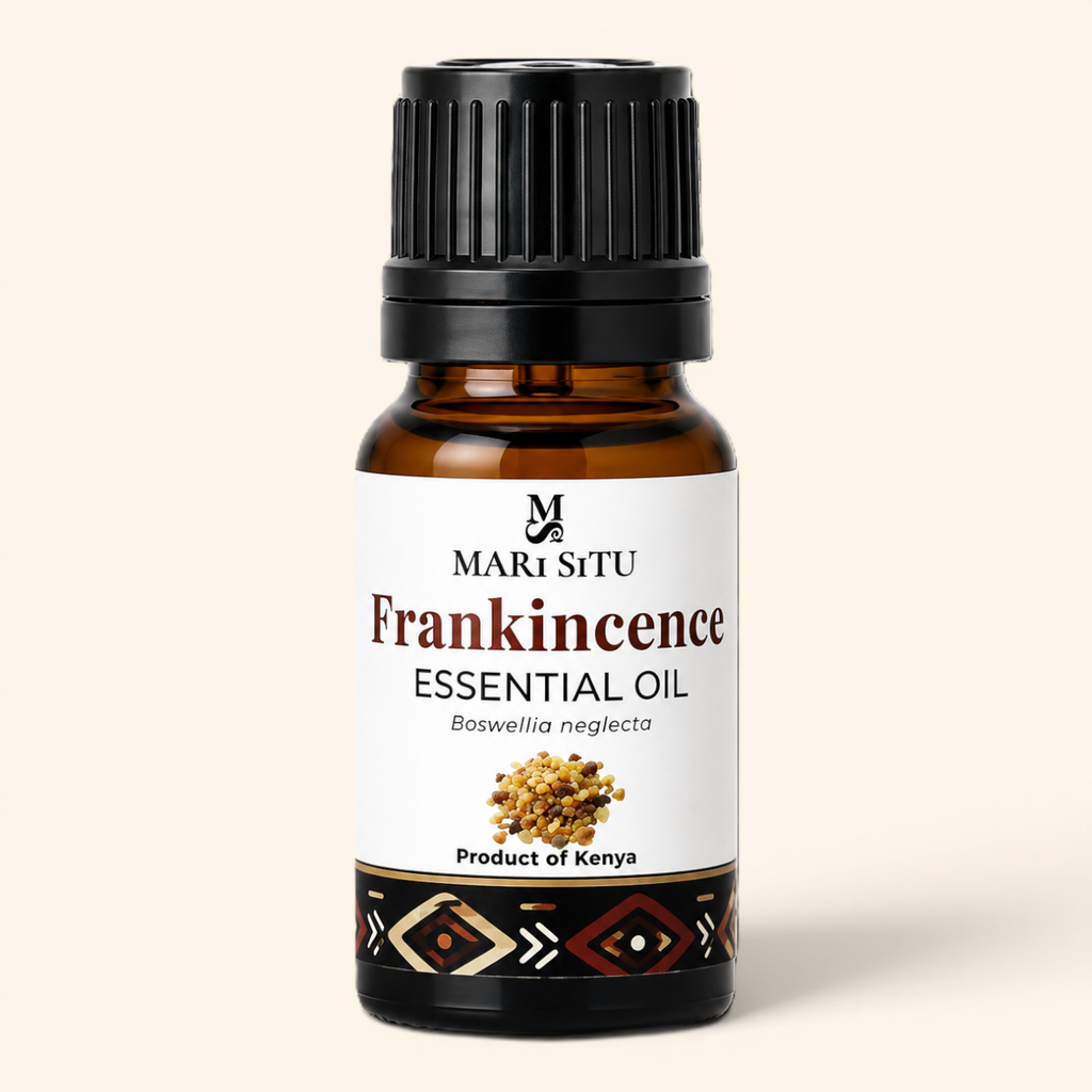 Frankincense Essential Oil – 10ml